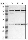 ANTI-RRP7A antibody produced in rabbit Prestige Antibodies® Powered by Atlas Antibodies, affinity isolated antibody, buffered aqueous glycerol solution