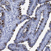 Anti-RSPH1 antibody produced in rabbit Prestige Antibodies® Powered by Atlas Antibodies, affinity isolated antibody, buffered aqueous glycerol solution