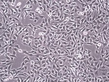 sBT-RMS Spontaneous Brain-tropic RET Melanoma-sorted Mouse Cell Line