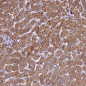 Anti-PET117 antibody produced in rabbit Prestige Antibodies® Powered by Atlas Antibodies, affinity isolated antibody, buffered aqueous glycerol solution