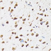 Anti-eIF2B epsilon (EIF2B5) Antibody, clone 5M2D4, Rabbit Monoclonal