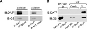 Anti-Dopamine Transporter Antibody, NT, clone DAT-Nt culture supernatant, clone DAT-Nt, Chemicon®