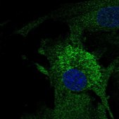 Anti-MFAP4 antibody produced in rabbit Prestige Antibodies® Powered by Atlas Antibodies, affinity isolated antibody, buffered aqueous glycerol solution