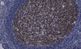 Anti-BCL-6 Antibody, clone 1B7 ZooMAb® Rabbit Monoclonal recombinant, expressed in HEK 293 cells