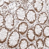 Anti-RCC1 antibody produced in rabbit Prestige Antibodies® Powered by Atlas Antibodies, affinity isolated antibody, buffered aqueous glycerol solution, ab2