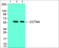 Anti-CCT6A antibody produced in rabbit affinity isolated antibody