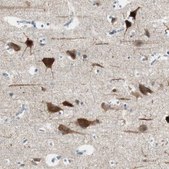 Anti-DLG4 antibody produced in rabbit Prestige Antibodies® Powered by Atlas Antibodies, affinity isolated antibody, buffered aqueous glycerol solution