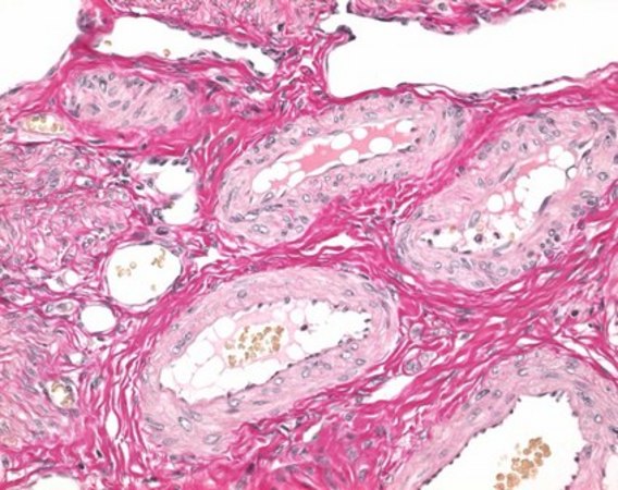 Weigert′s iron hematoxylin kit for nuclear staining in histology