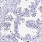 Anti-PEG10 antibody produced in rabbit Prestige Antibodies® Powered by Atlas Antibodies, affinity isolated antibody, buffered aqueous glycerol solution
