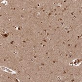 Anti-POLR3A antibody produced in rabbit Prestige Antibodies® Powered by Atlas Antibodies, affinity isolated antibody, buffered aqueous glycerol solution
