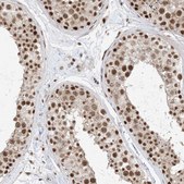 Anti-SF3A3 antibody produced in rabbit Prestige Antibodies® Powered by Atlas Antibodies, affinity isolated antibody, buffered aqueous glycerol solution