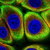 Anti-KRT8 antibody produced in rabbit Prestige Antibodies® Powered by Atlas Antibodies, affinity isolated antibody, buffered aqueous glycerol solution