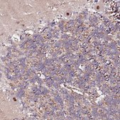 Anti-PPP2R5B antibody produced in rabbit Prestige Antibodies® Powered by Atlas Antibodies, affinity isolated antibody, buffered aqueous glycerol solution