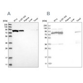 Anti-ABCF2 antibody produced in rabbit Prestige Antibodies® Powered by Atlas Antibodies, affinity isolated antibody, buffered aqueous glycerol solution