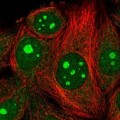 Anti-MRPL4 antibody produced in rabbit Prestige Antibodies® Powered by Atlas Antibodies, affinity isolated antibody, buffered aqueous glycerol solution