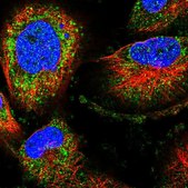 Anti-STK36 antibody produced in rabbit Prestige Antibodies® Powered by Atlas Antibodies, affinity isolated antibody, buffered aqueous glycerol solution, ab2