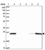 Anti-ARHGDIB antibody produced in rabbit Prestige Antibodies® Powered by Atlas Antibodies, affinity isolated antibody, buffered aqueous glycerol solution