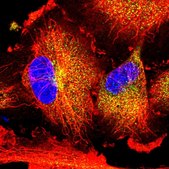 Anti-NBPF15 antibody produced in rabbit Prestige Antibodies® Powered by Atlas Antibodies, affinity isolated antibody, buffered aqueous glycerol solution