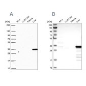 Anti-SULT2A1 antibody produced in rabbit Prestige Antibodies® Powered by Atlas Antibodies, affinity isolated antibody, buffered aqueous glycerol solution