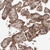 Anti-CDC42BPB antibody produced in rabbit Prestige Antibodies® Powered by Atlas Antibodies, affinity isolated antibody, buffered aqueous glycerol solution