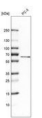 Anti-MCOLN1 antibody produced in rabbit Prestige Antibodies® Powered by Atlas Antibodies, affinity isolated antibody, buffered aqueous glycerol solution