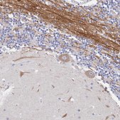 Anti-ACAD11 antibody produced in rabbit Prestige Antibodies® Powered by Atlas Antibodies, affinity isolated antibody, buffered aqueous glycerol solution