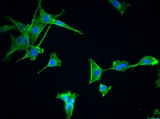 OSUMMER.13 Mouse NRAS-Mutant Melanoma Cell Line