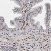 Anti-ZEB1 antibody produced in rabbit Prestige Antibodies® Powered by Atlas Antibodies, affinity isolated antibody, buffered aqueous glycerol solution
