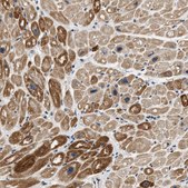 Anti-OBSCN antibody produced in rabbit Prestige Antibodies® Powered by Atlas Antibodies, affinity isolated antibody, buffered aqueous glycerol solution, Ab2