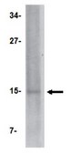 Anti-NANOS2 Antibody from rabbit, purified by affinity chromatography