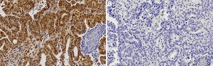 Anti-Estrogen Receptor α Antibody from rabbit, purified by affinity chromatography