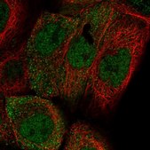 Anti-ADIRF antibody produced in rabbit Prestige Antibodies® Powered by Atlas Antibodies, affinity isolated antibody, buffered aqueous glycerol solution