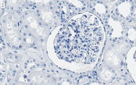 Anti-Tissue Factor Antibody, clone 2L10 ZooMAb® Rabbit Monoclonal recombinant, expressed in HEK 293 cells