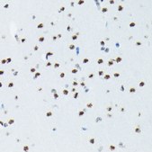 Anti-Phospho-p70 S6 Kinase 1-T421/S424 antibody produced in rabbit