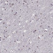 Anti-ADAM11 Prestige Antibodies® Powered by Atlas Antibodies, affinity isolated antibody