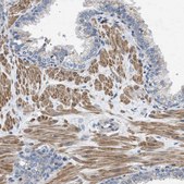 Anti-HSPB8 antibody produced in rabbit Prestige Antibodies® Powered by Atlas Antibodies, affinity isolated antibody, buffered aqueous glycerol solution