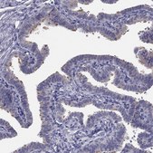 Anti-CCDC40 antibody produced in rabbit Prestige Antibodies® Powered by Atlas Antibodies, affinity isolated antibody, buffered aqueous glycerol solution