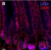 Anti-LIG4 antibody produced in rabbit Prestige Antibodies® Powered by Atlas Antibodies, affinity isolated antibody, buffered aqueous glycerol solution