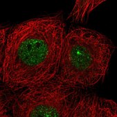 Anti-CIZ1 antibody produced in rabbit Prestige Antibodies® Powered by Atlas Antibodies, affinity isolated antibody, buffered aqueous glycerol solution