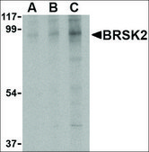 Anti-BRSK2 antibody produced in rabbit affinity isolated antibody, buffered aqueous solution