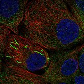 Anti-IMPDH2 antibody produced in rabbit Prestige Antibodies® Powered by Atlas Antibodies, affinity isolated antibody, buffered aqueous glycerol solution