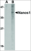 Anti-Nanos1 (ab1) antibody produced in rabbit affinity isolated antibody, buffered aqueous solution