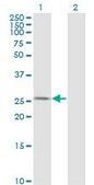 Monoclonal Anti-AK3 antibody produced in mouse clone 1D2, purified immunoglobulin, buffered aqueous solution