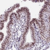 Anti-ZC3H4 antibody produced in rabbit Prestige Antibodies® Powered by Atlas Antibodies, affinity isolated antibody, buffered aqueous glycerol solution