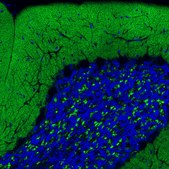 Monoclonal Anti-VGLUT1 antibody produced in mouse Prestige Antibodies® Powered by Atlas Antibodies, clone CL2754, purified immunoglobulin, buffered aqueous glycerol solution