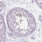 Anti-CEP19 antibody produced in rabbit Prestige Antibodies® Powered by Atlas Antibodies, affinity isolated antibody, buffered aqueous glycerol solution