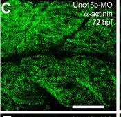 Monoclonal Anti-α-Actinin (Sarcomeric) antibody produced in mouse clone EA-53, ascites fluid