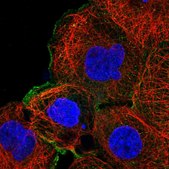 Anti-MAP2K1 antibody produced in rabbit Prestige Antibodies® Powered by Atlas Antibodies, affinity isolated antibody, buffered aqueous glycerol solution
