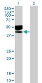 Anti-IL1R2 antibody produced in mouse IgG fraction of antiserum, buffered aqueous solution