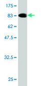 Monoclonal Anti-CHFR antibody produced in mouse clone 1H3-A12, purified immunoglobulin, buffered aqueous solution